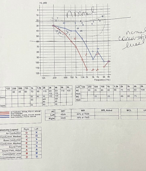 Less than 36% of spoken words are understandable
